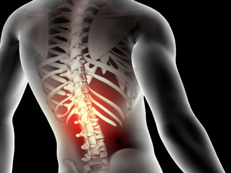 Bedah Tulang Belakang 3D: Lebih Akurat Berkat Neuronavigation