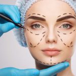 Operasi Plastik Trend Dari Dunia Medis Modern